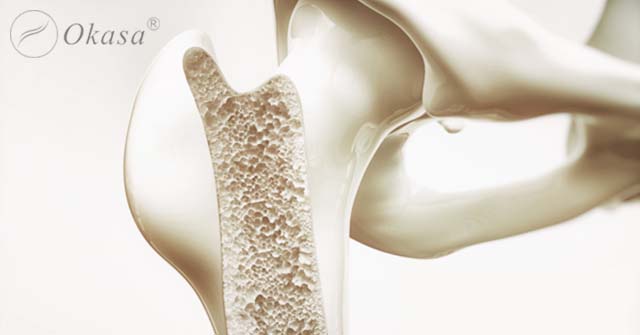 Mối liên hệ giữa hormone và bệnh loãng xương