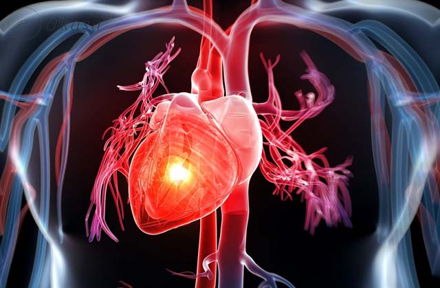 Mức độ nguy hiểm của bệnh tim