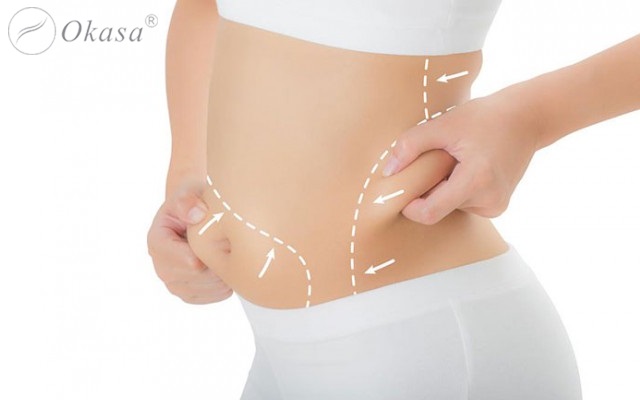 Người béo phì sau khi hút mỡ có thể gặp một số vấn đề về sức khỏe