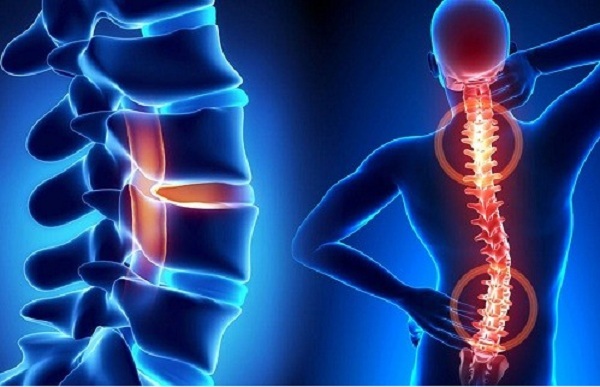 nguyên nhân đau lưng dưới ở nam giới
