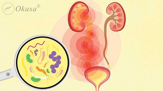 Nguyên nhân gây đau vùng bụng dưới