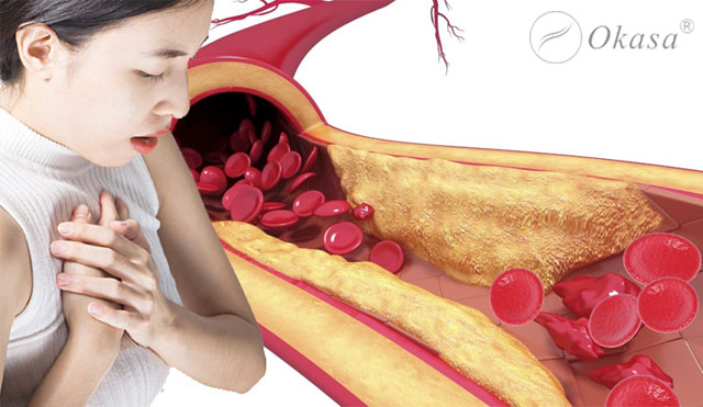 Nguyên nhân gây ra tình trạng thiếu máu cơ tim