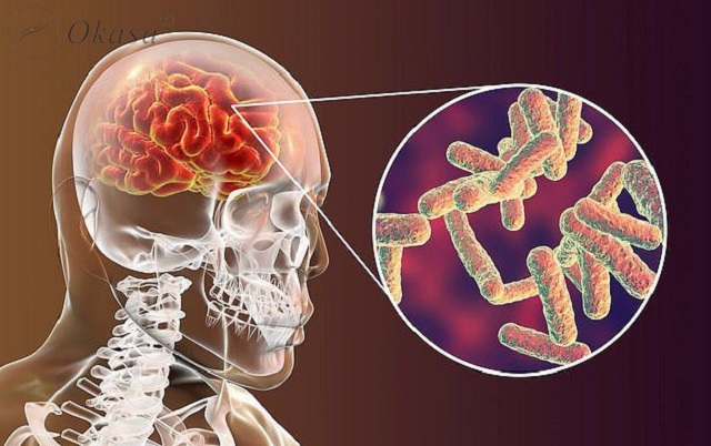 Nguyên nhân khiến bạn bị nhức đầu, buồn nôn