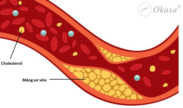 Nguyên nhân khiến cholesterol tăng cao