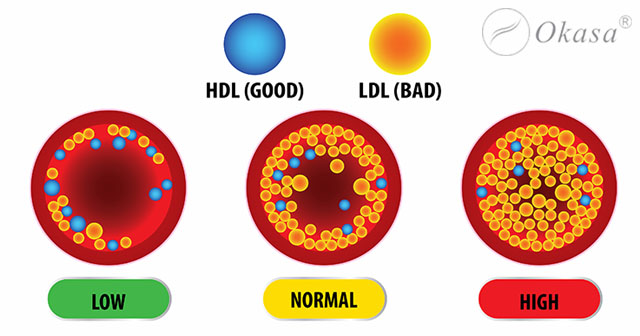Nguyên nhân khiến cholesterol tăng cao