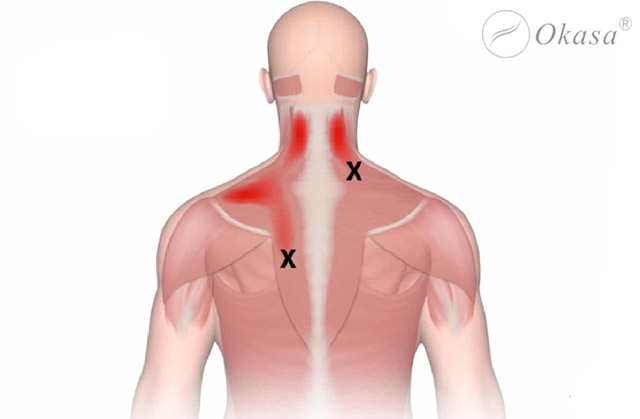 Nguyên nhân quá tải và đau nhức cơ bắp