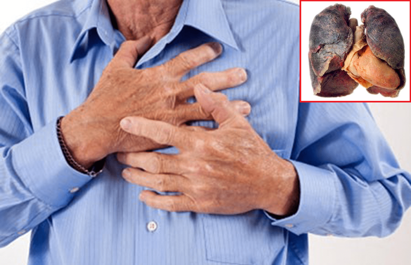 Nguyên nhân tình trạng đau vùng lưng sau phổi
