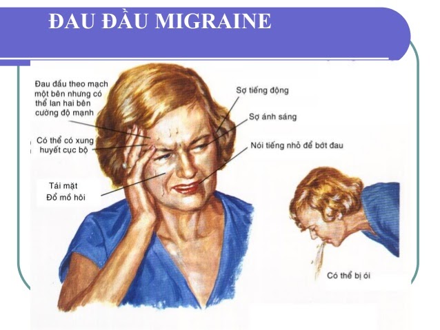 nhức đầu liên tục nhiều ngày là bệnh gì