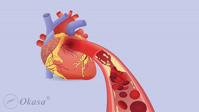 Những bệnh lý thường gặp liên quan đến tim