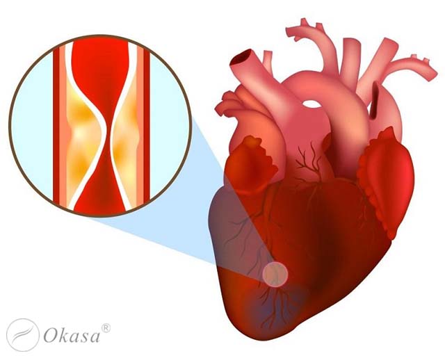 Những bệnh lý thường gặp liên quan đến tim