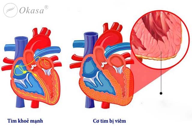 Những bệnh lý thường gặp liên quan đến tim