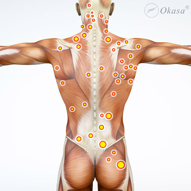 Những điều cần biết về điểm nút cơ