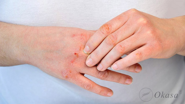 Những lợi ích từ liệu pháp mùi hương