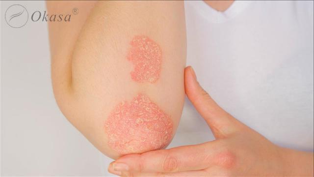 Những lợi ích và bất cập của massage đá nóng