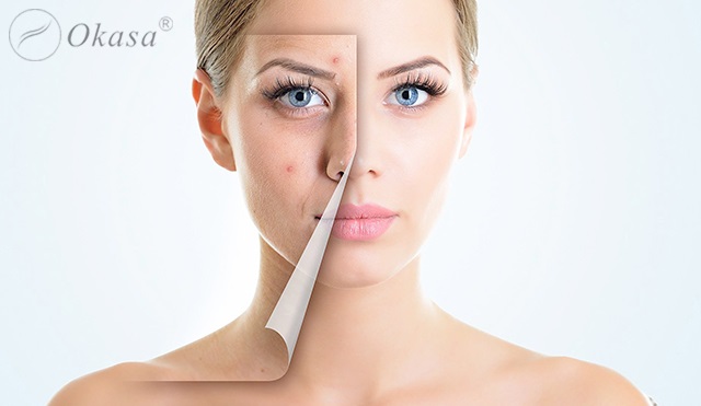 Những tác động tiêu cực đến cơ thể khi bị mất ngủ kéo dài