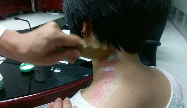 Những nguy cơ khi thực hiện massage cổ
