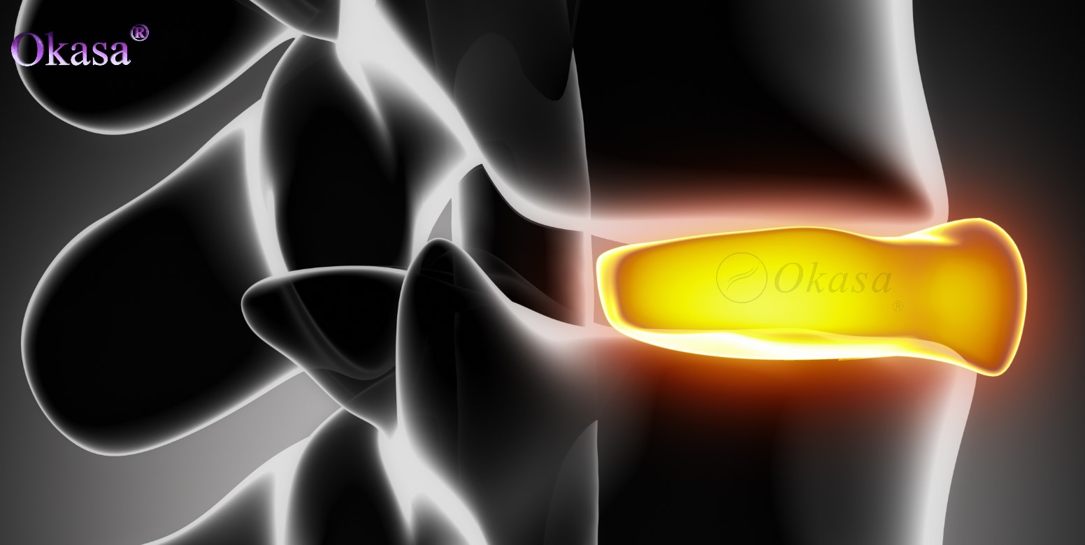 phồng đĩa đệm