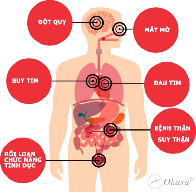 Phòng ngừa bệnh cao huyết áp