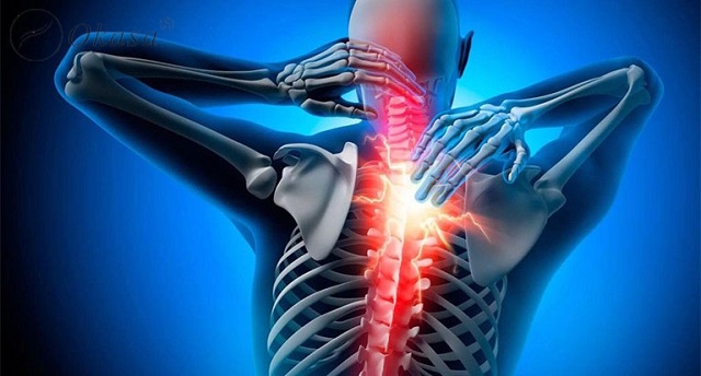 Phòng ngừa bệnh thoát vị đĩa đệm