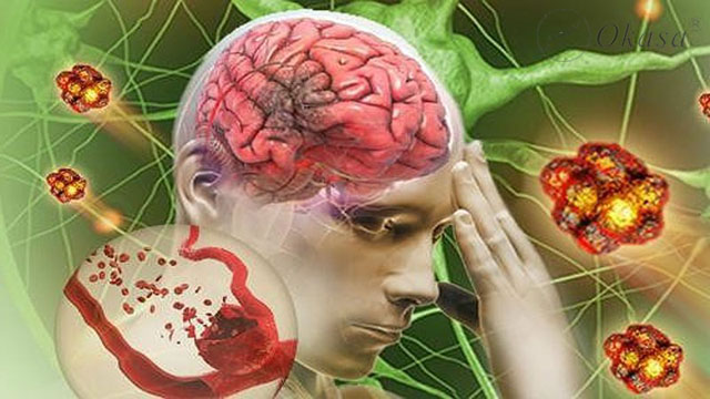 Phòng tránh đột quỵ do tăng huyết áp