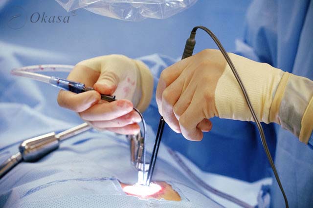 Phương pháp điều trị thiếu máu cơ tim