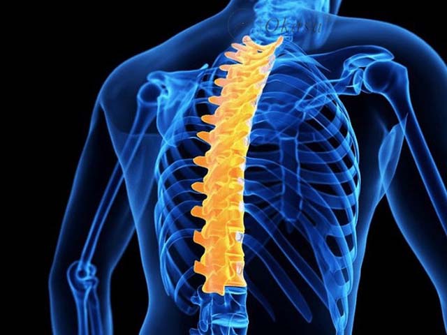 Phương pháp điều trị vẹo cột sống ngực