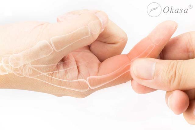 Phương pháp điều trị viêm khớp ngón tay