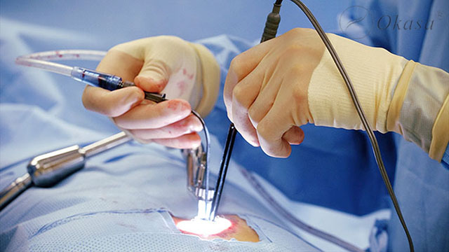 Phương pháp điều trị xơ vữa động mạch