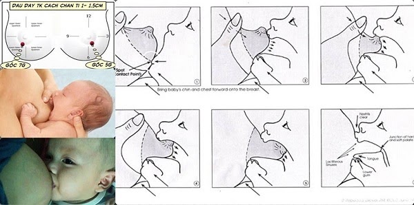 phương pháp mát xa 3 phút betibuti cho mẹ bỉm sữa