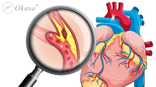 Phương pháp phục hồi chức năng tim mạch