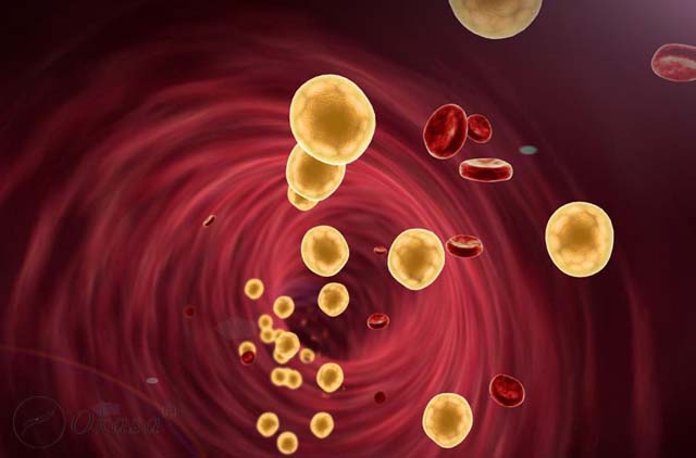 Rối loạn lipid máu và nguy cơ mắc các bệnh tim mạch