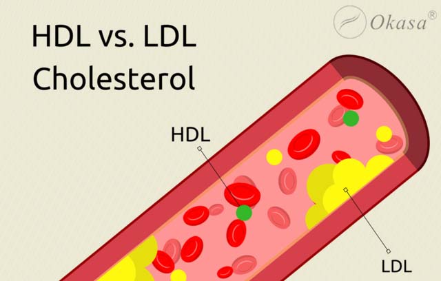 Rối loạn lipid máu và nguy cơ mắc các bệnh tim mạch
