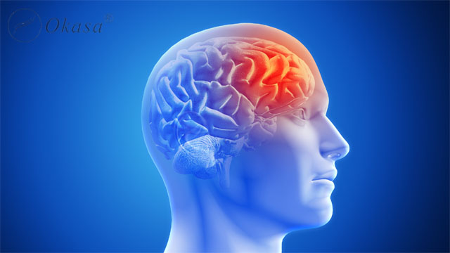Rung nhĩ có mối liên hệ mật thiết với đột quỵ não