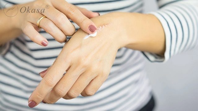 Sử dụng tinh dầu tràm trà trị sẹo lồi tại nhà