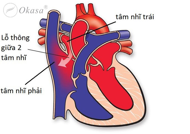 Chức năng và các bệnh lý của tâm nhĩ
