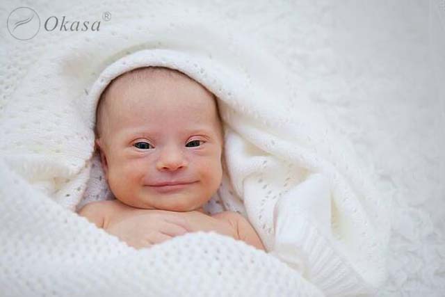 Hẹp eo động mạch chủ khiến huyết áp tăng