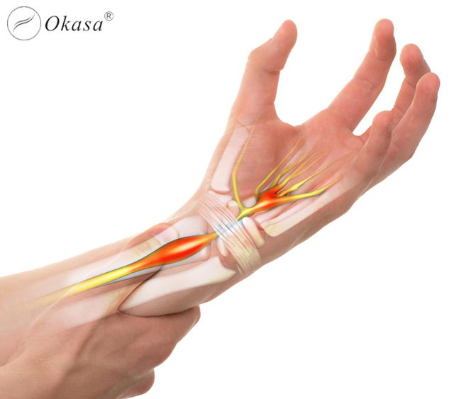 Liệu pháp massage điều trị hội chứng ống cổ tay