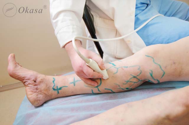 Tắc động mạch ngoại biên chi dưới là gì?