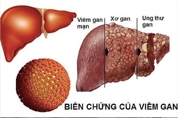 tác dụng của cây cỏ xước trong y học