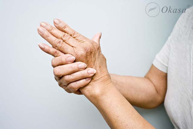Tác hại của bệnh viêm khớp vảy nến và phương pháp điều trị