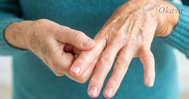 Tác hại của bệnh viêm khớp vảy nến và phương pháp điều trị