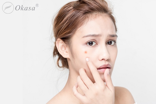 Tác hại của stress với da và cách khắc phục