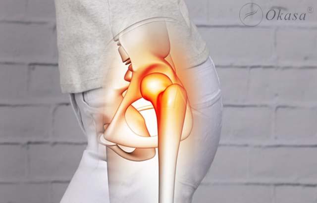 Thay khớp háng cần lưu ý những gì?