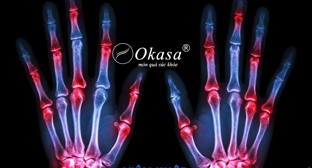 thoái hóa khớp ngón tay