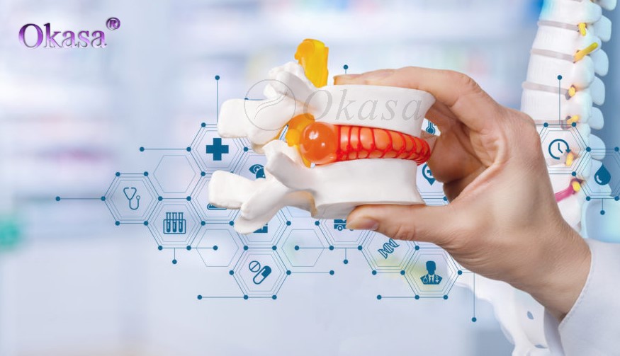 thoát vị đĩa đệm do bị phồng