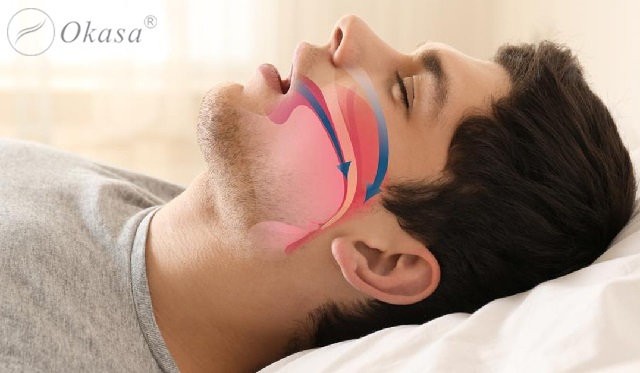 Tìm hiểu chứng ngưng thở khi ngủ ở người béo phì