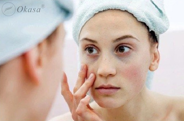 Tìm hiểu nguyên nhân ngủ đủ giấc nhưng mắt vẫn thâm