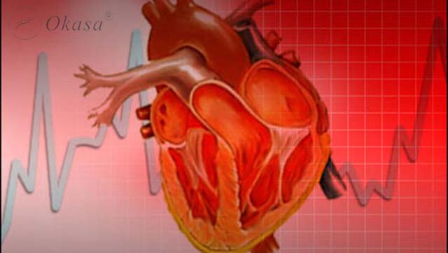 Tìm hiều về tình trạng sốc tim