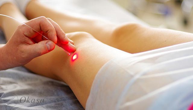 Triệu chứng và điều trị suy van tĩnh mạch sâu