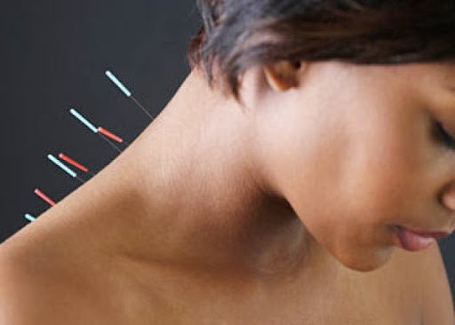 Triệu chứng đau nửa đầu sau gáy